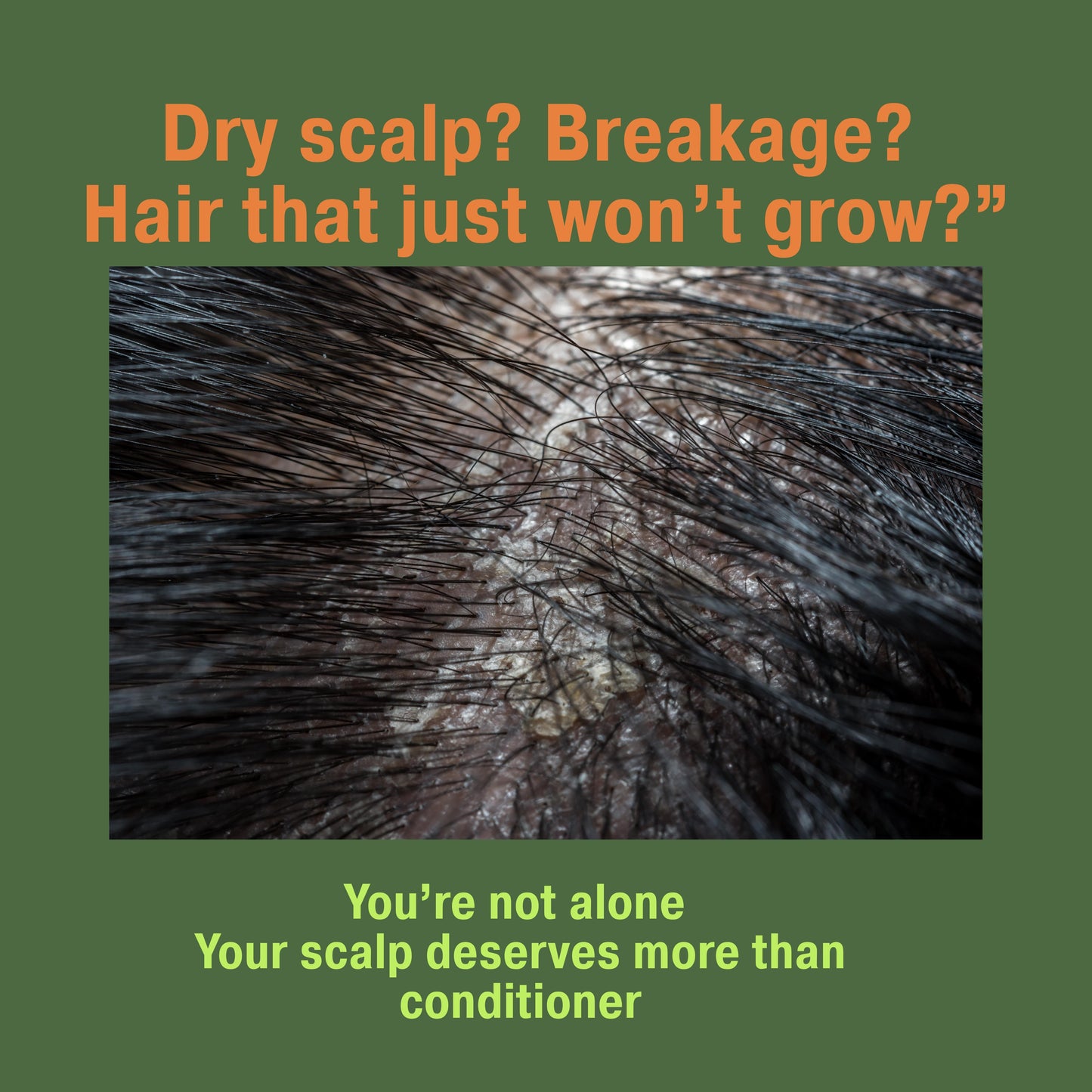 Dry scalp image to highlight problem top best scalp oil
